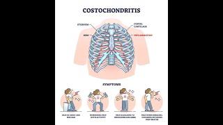 Costochondritis (Inflammation of Rib Cartilage) ; Definition, Causes, Symptoms, Diagnosis, Treatment