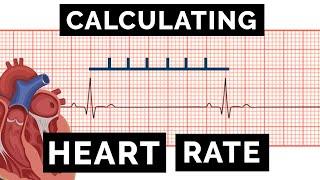 Calculating Heart Rate on an ECG | EKG | OSCE Guide | UKMLA | CPSA | PLAB 2