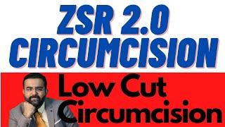 ZSR 2.0 Stapler Circumcision Surgery | Most Advanced | Low Cut ZSR 2.0 Circumcision by Dr.Kuber S