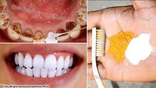 Secret that Dentists don't want you to know, Teeth whitening at home in just 2 minutes🪥