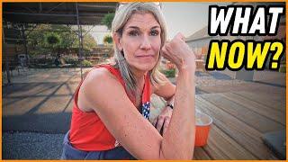 A SIMPLE RV MISTAKE LED TO THIS PAINFUL INJURY!