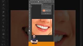 white teeth with 1 click