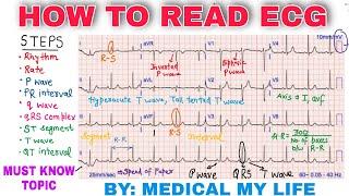 How To Read An ECG