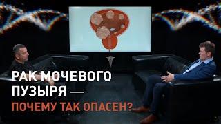 Рак мочевого пузыря – почему так опасен? Отвечает онколог Антон Вадимович Ёлкин.