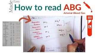 How to check ABG or arterial blood gas || ABG Interpretation