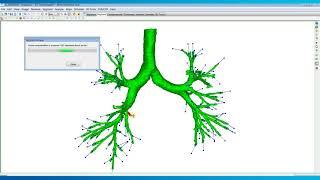 How to Automatically Segment Airways | Mimics Innovation Suite | Materialise Medical