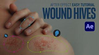 After Effects hives wounds Easy Animated Tutorial