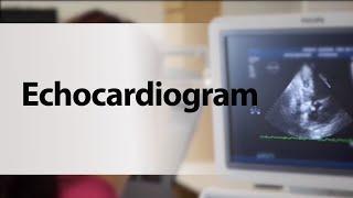 Echocardiogram