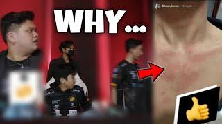 CLARIFICATION WHY LEMON WALKOUT IN MPL STAGE… 