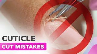 Don'ts When Cutting the Cuticle | Manicure Mistakes