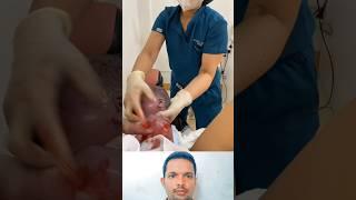 Mother painful delivery newborn twins baby ! #shorts #viralshorts #hospital #cutebaby #mother #new