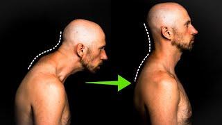 Fix Your Forward Head Posture: It's Not About Your Smartphone!