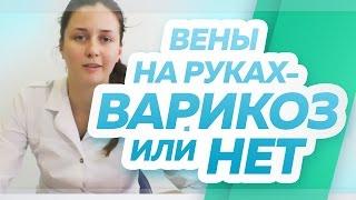 Вены на руках, варикозная болезнь на руках – есть она или нет? Флебологический центр "Антирефлюкс"