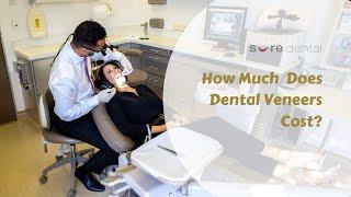 How Much  Does Dental Veneers Cost?