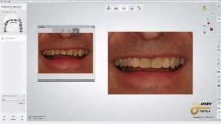 RealView Engine™ with 2D Image Overlay with lifelike teeth
