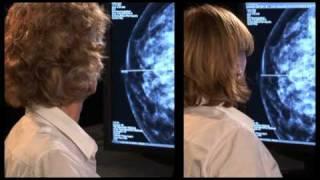 Informationen zum Mammographie-Screening-Programm in Deutschland
