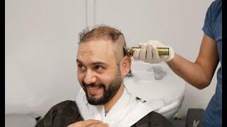 Best Hair Transplant Clinic in Istanbul | Dr. Bayer Clinics 