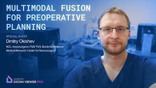 Inobitec DICOM Viewer Pro: Multimodal Fusion for Preoperative Planning