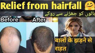 Relief from hair fall by Dr Sobia Noor #haircare #hairfallsolution #hairgrowth