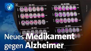 USA lassen neues Alzheimermedikament „Leqembi“ zu