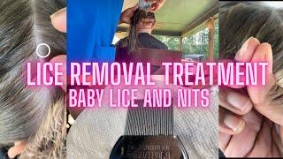 Lice Removal Treatment l Baby Lice and Eggs  l Head Lice Removal l @staceythelouselady