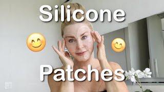 Silicone Patches to Treat Wrinkles, Keloid Scars & Stretch Marks | Anti-Aging | Beauty Over 50