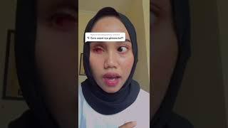 wanita dengan mata palsu tetap bersyukur