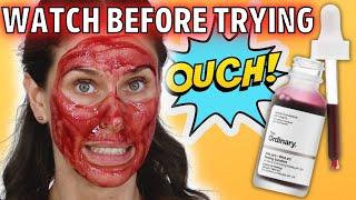 I used the ordinary peeling solution for 3 years and THIS is what it did to my face...