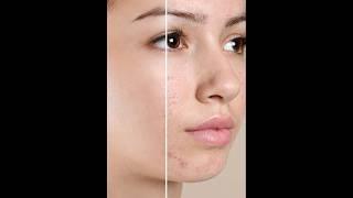 Photoshop Tricks-Smooth Skin with Simple Steps in1 Min