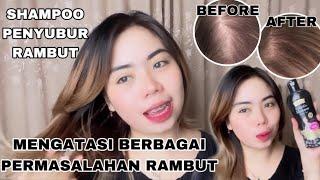 RAMBUT SEHAT LEBAT ANTI RONTOK‼️SHAMPOO KEMIRI BAKAR