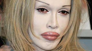 La Trágica Vida De Pete Burns Es Simplemente Desgarradora