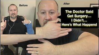 My Broken Wrist "NO SURGERY" experience / Story!!! Update on fractured wrist with no surgery results