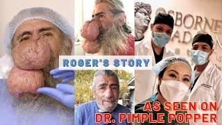 Roger's Nose Surgery Story: As Seen on Dr. Pimple Popper Season 6 Episode 2