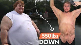 How I Lost 550lbs & Got My Life Back | BRAND NEW ME
