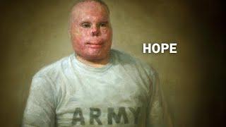 American Hero, Retired Army Sergeant, Rick Yarosh's Story, Finding Hope Again & Being A True Leader