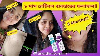  রেটিনল সিরাম - আমার ৮ মাসের অভিজ্ঞতা । RETINOL Before and After