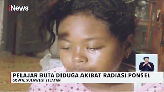 Siswi SD di Gowa Buta Diduga Akibat Radiasi HP saat Belajar Online - iNews Siang 20/11