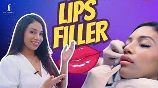 Lip Fillers Testimonial Review: Transform Your Pout