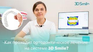 Как проходит ортодонтическое лечение на системе 3D Smile?