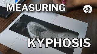 How to Hand Measure Kyphosis, Lordosis, and Pelvic Incidence on X-rays