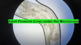 Adult Pinworm Microscopy