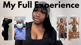 HOW MUCH I PAID FOR MY BBL IN COLOMBIA | MY FULL EXPERIENCE! LLUXE RECOVERY DR. PENA