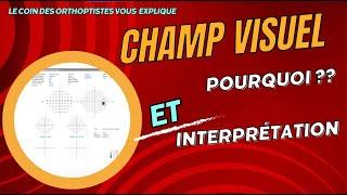 Pourquoi faire un champ visuel ? Comment lire un champ visuel ? (Ophtalmologie/Orthoptie)