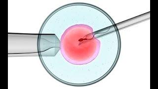 Yumurtaların Spermle Döllenmesi Nasıl Yapılır? - Op. Dr. Emre Karatekelioğlu