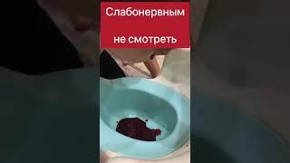 Как остановить носовое кровотечение!