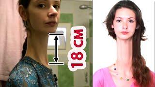 "A girl from the planet Nibiru." The Crimean woman has a neck of 18 cm with a height of 202 cm.