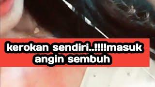 Kerokan dada wanita masuk angin terbaru 2022