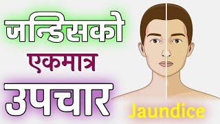 Jaundice in nepali | Symptoms of jundice in Nepali | Causes and Treatment of jaundice  in Nepali