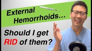 External hemorrhoid treatment: Should I REMOVE or LEAVE them?
