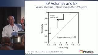 Top 10 Facts About Right Ventricular Function